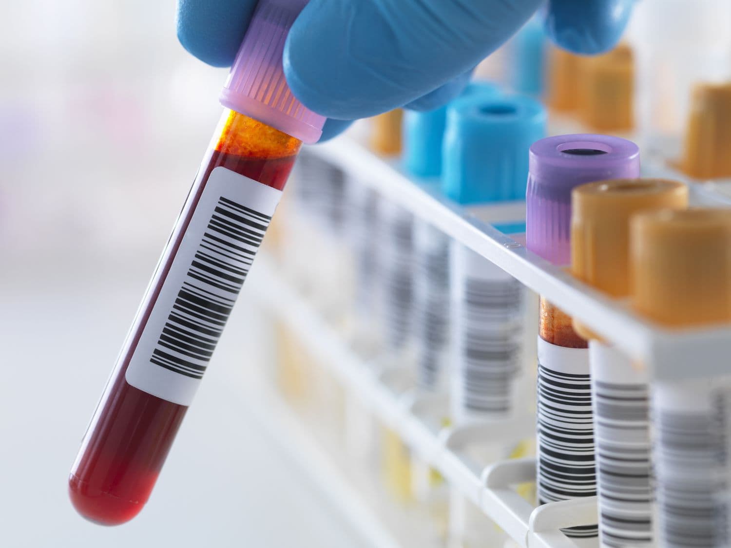 Self-Pay Lab Testing